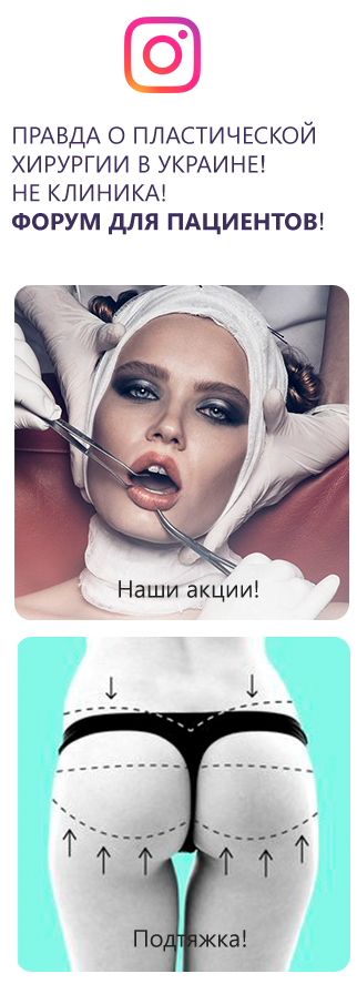 банер
